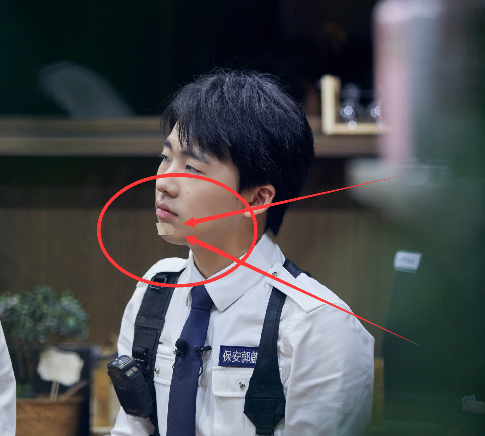 郭麒麟|《密逃》安全隐患终于暴露,郭麒麟下巴磕破,看着都疼