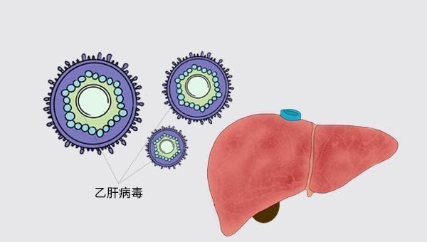 乙肝|吃着抗病毒药物怎么还肝硬化了？医生告诉你原因，乙肝患者要了解