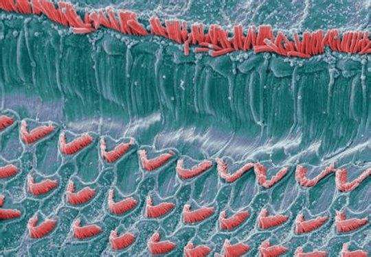 神经元：安静时： 我们大脑里听到的“嘤”声到底是什么？