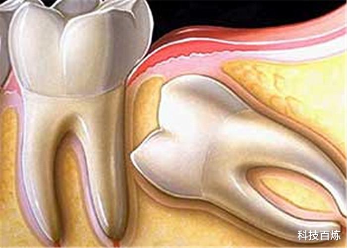 【】专家：人类进化并不完全，身体还有6个“漏洞”，你知道几个？