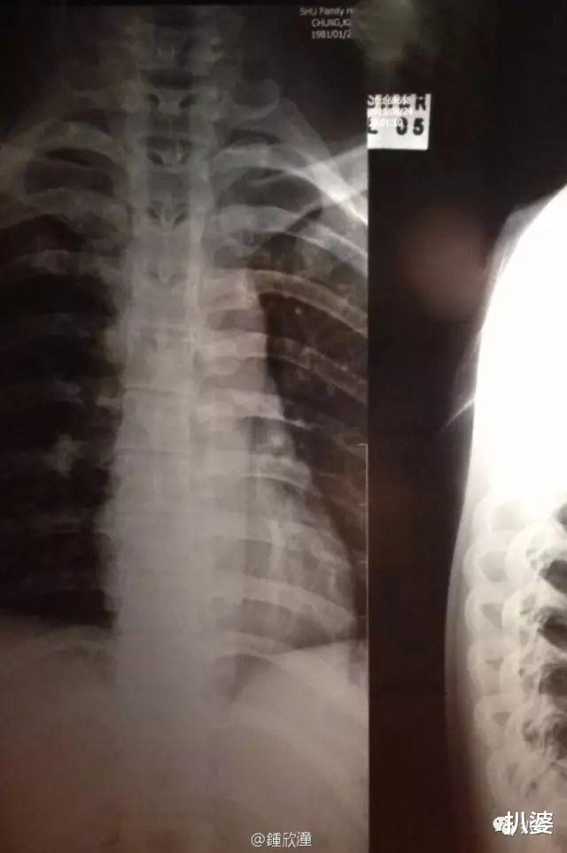 阿娇|离奇受伤的阿娇，又有新故事了。