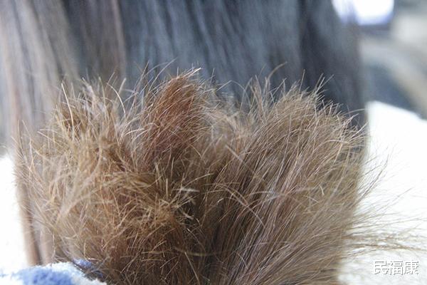 高血脂|肝癌怎么一发现就是晚期？医生：头部出现4种表现，尽快检查肝脏