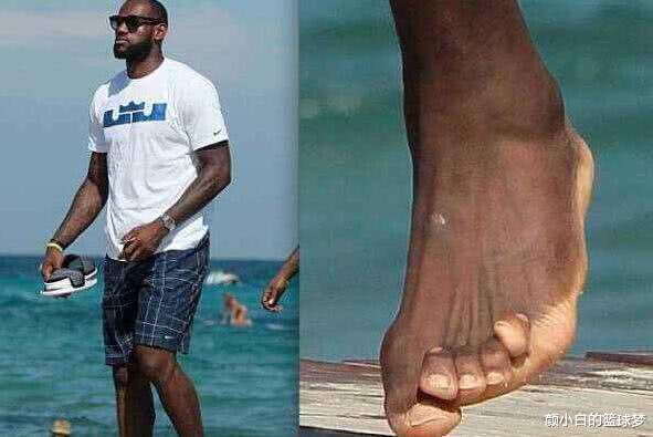 [勒布朗·詹姆斯]鲨鱼IG晒洗脚照，脚趾恐怖程度詹皇都汗颜，多位明星感叹“天啊”