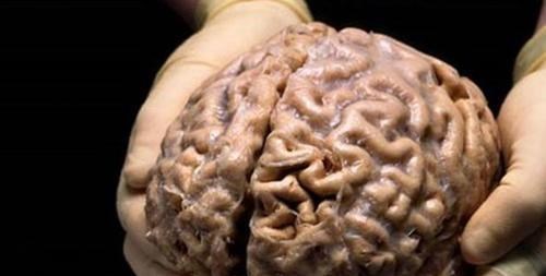 科学家|科学家培育出“人造大脑”,却不小心唤醒其意识!