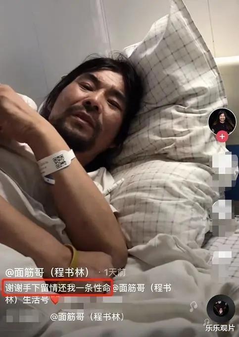 面筋哥|面筋哥患肺癌晚期接受手术，整个人已经瘦到完全脱相