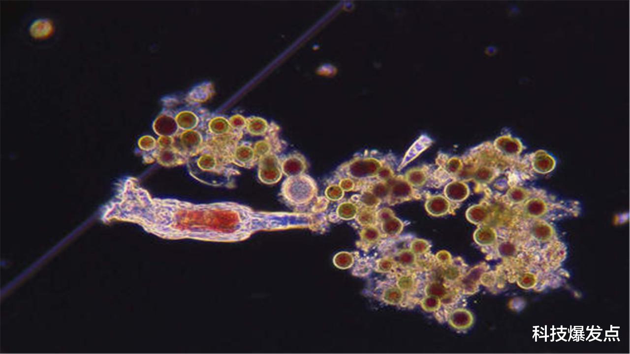 食脑虫|美国再现“食脑虫”,寻找食物致人死亡,截止2019年仅4名幸存者!