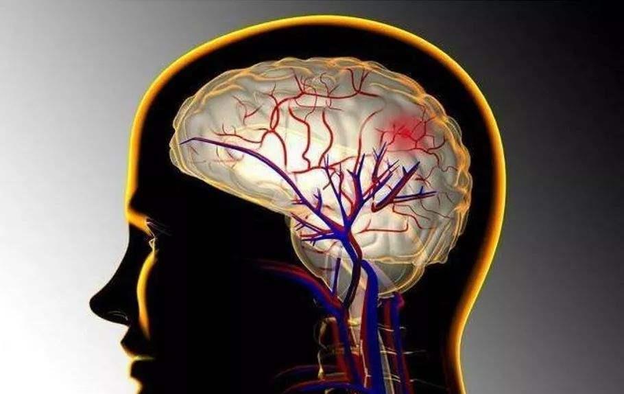 脑梗|会不会脑梗，用手点点鼻尖就知道了，快测一下自己离脑梗有多远