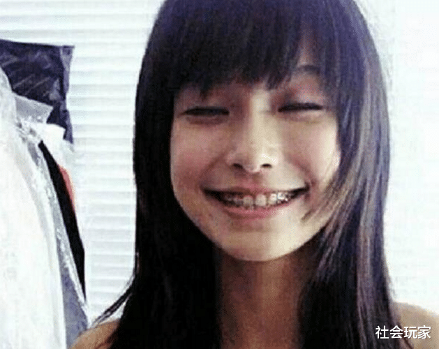 【Angelababy】杨颖最想删掉的照片，生理期不算啥，牙套不算啥，最后一张是王者