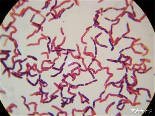 猛犸象|疯狂科学家为获永生，大胆注射350万年前猛犸象细菌，结果如何？