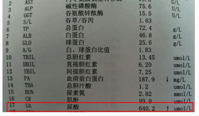 [痛风]尿酸超标怎么办？别慌，只要学会3方法，不吃药也能降，看完就会