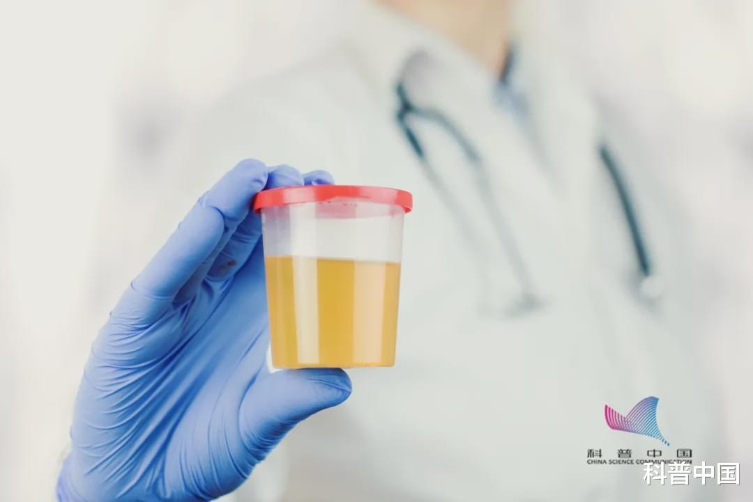 疾病|注意！上完厕所最好看一眼，尿液出现这几种颜色要当心了！