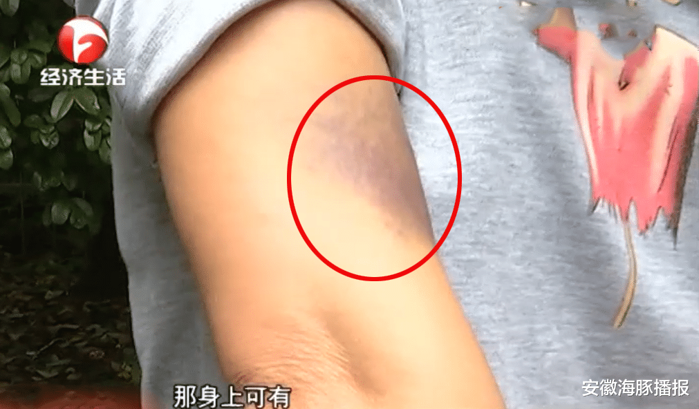 安徽海豚播报|因为不给儿子玩手机，上初二的儿子把母亲踢骨折，儿子：她自找的