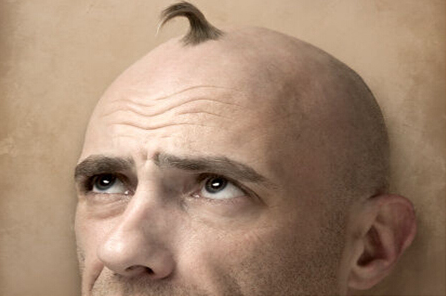 #脱发#男性出现脱发现象的原因是那些？