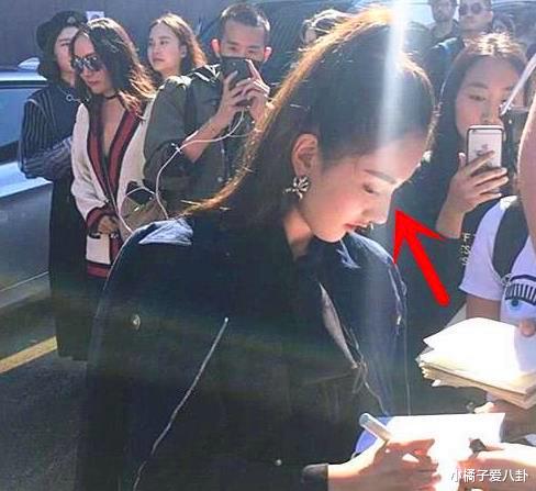 Angelababy|佟丽娅用亲身经历“警告”女星,整容后别在阳光下拍照:杨颖郭碧婷好尴尬