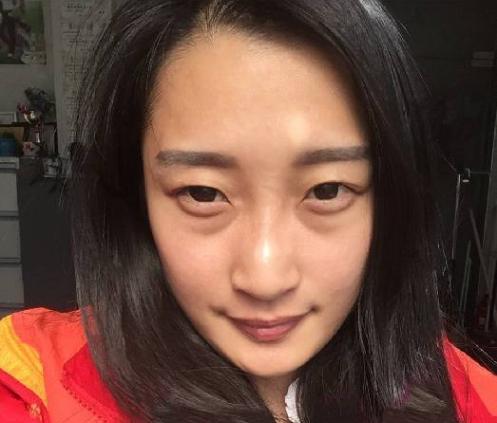 #眼霜#好用到“爆”的眼霜！戚薇：我都用3年了，网友：眼袋细纹全没了