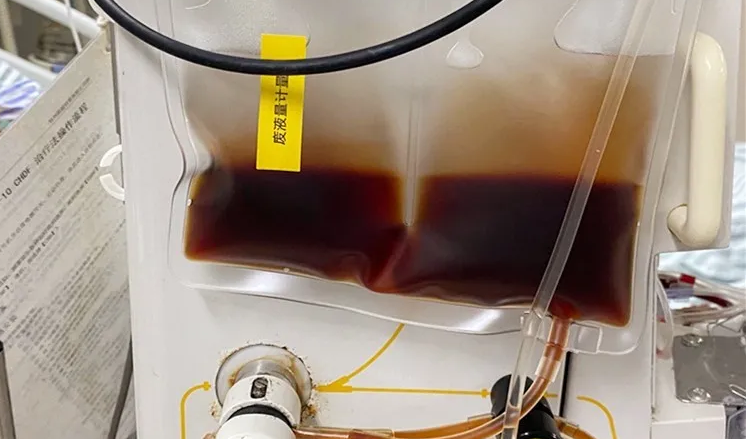 浙样的生活|散步进了ICU，两天还没脱离生命危险！杭州近一个月有600多人中招