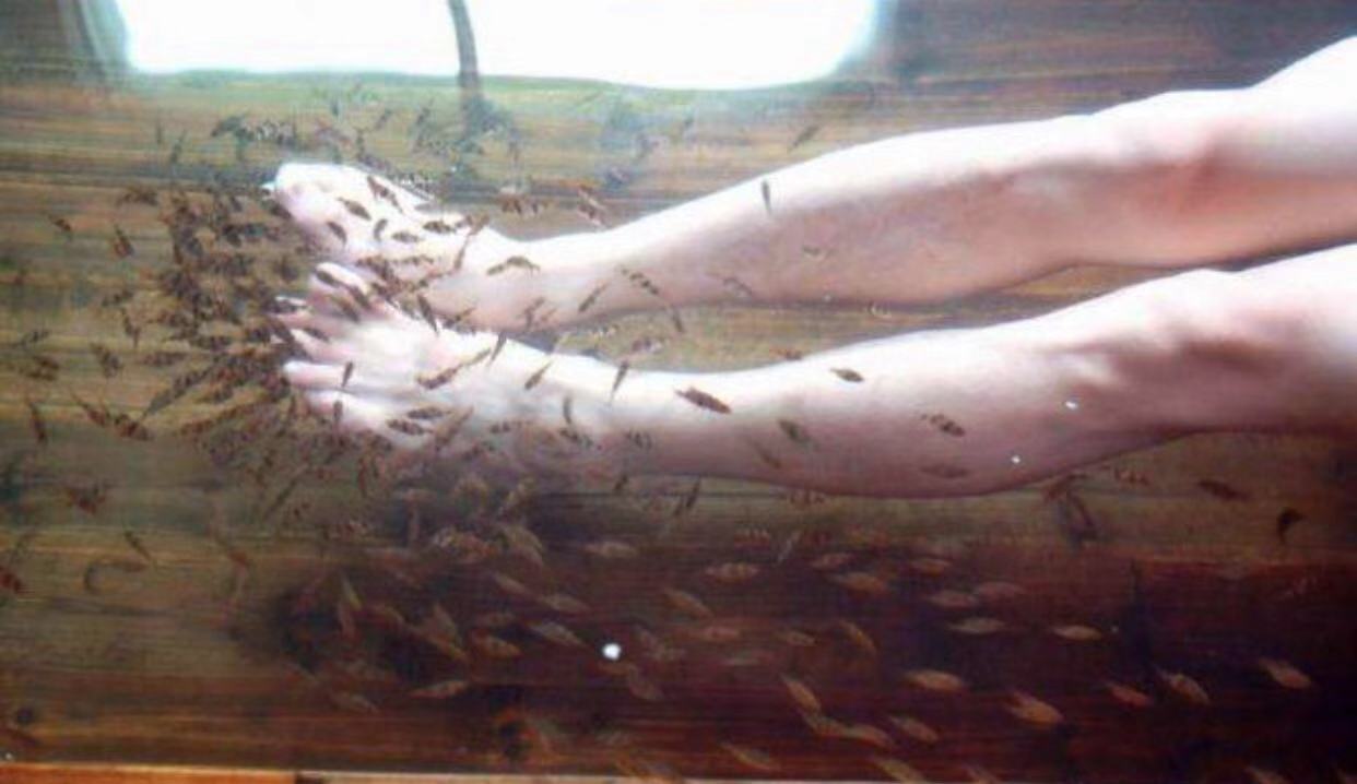 尿失禁|尴尬！女子做鱼疗太舒服导致“尿失禁”，结果小鱼全翻肚