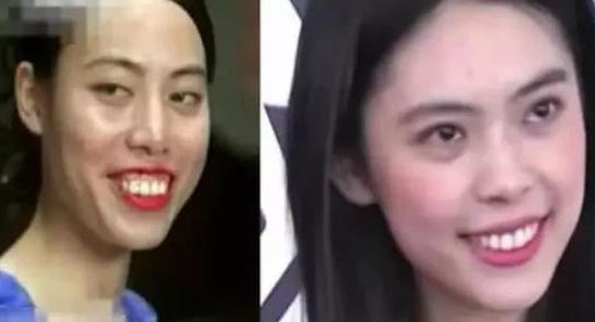 「整容」周星驰骗了我们这么久，她明明没有这么丑，化妆后却变成龅牙妹！