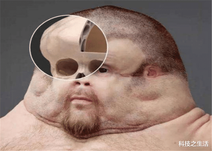 科学家▲人类进化已经完成？未来人类的模样曝光，网友：幸亏早出生了！