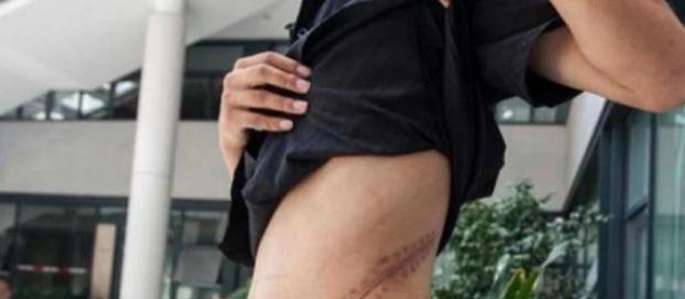 苹果|还记得10年前，用一个肾换苹果4手机的17岁高中生吗？后来如何