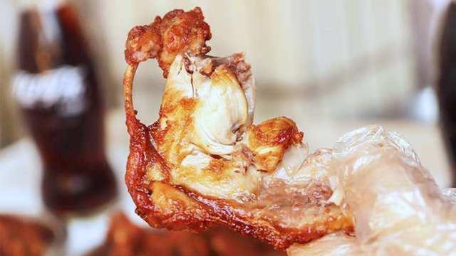 『肾结石』辟谣：长肾结石是因为水里面有水垢？其实肾结石更喜欢2类人