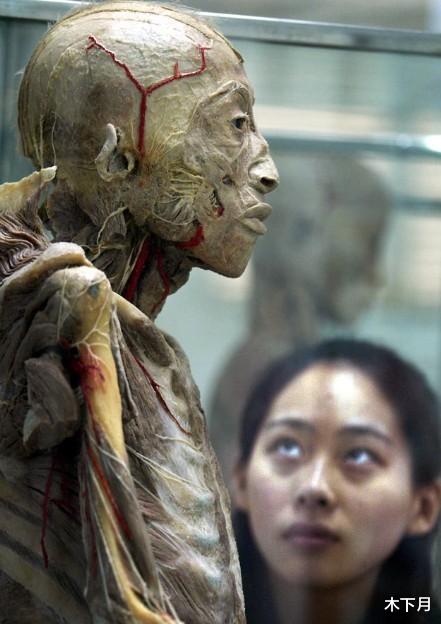 【】人死后24小时内，尸体主要有哪些变化？