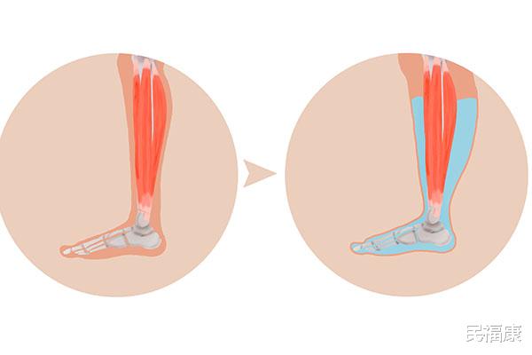 衰老|男人老没老，下半身会“实言相告”，老态一个不占，说明你还年轻