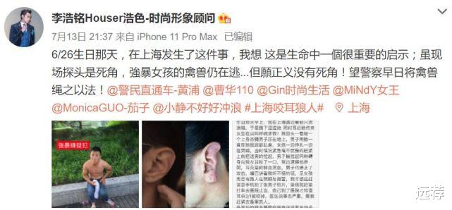 远荐|上海小伙见义勇为救被侵害女孩！耳朵被当场咬掉鲜血直流！