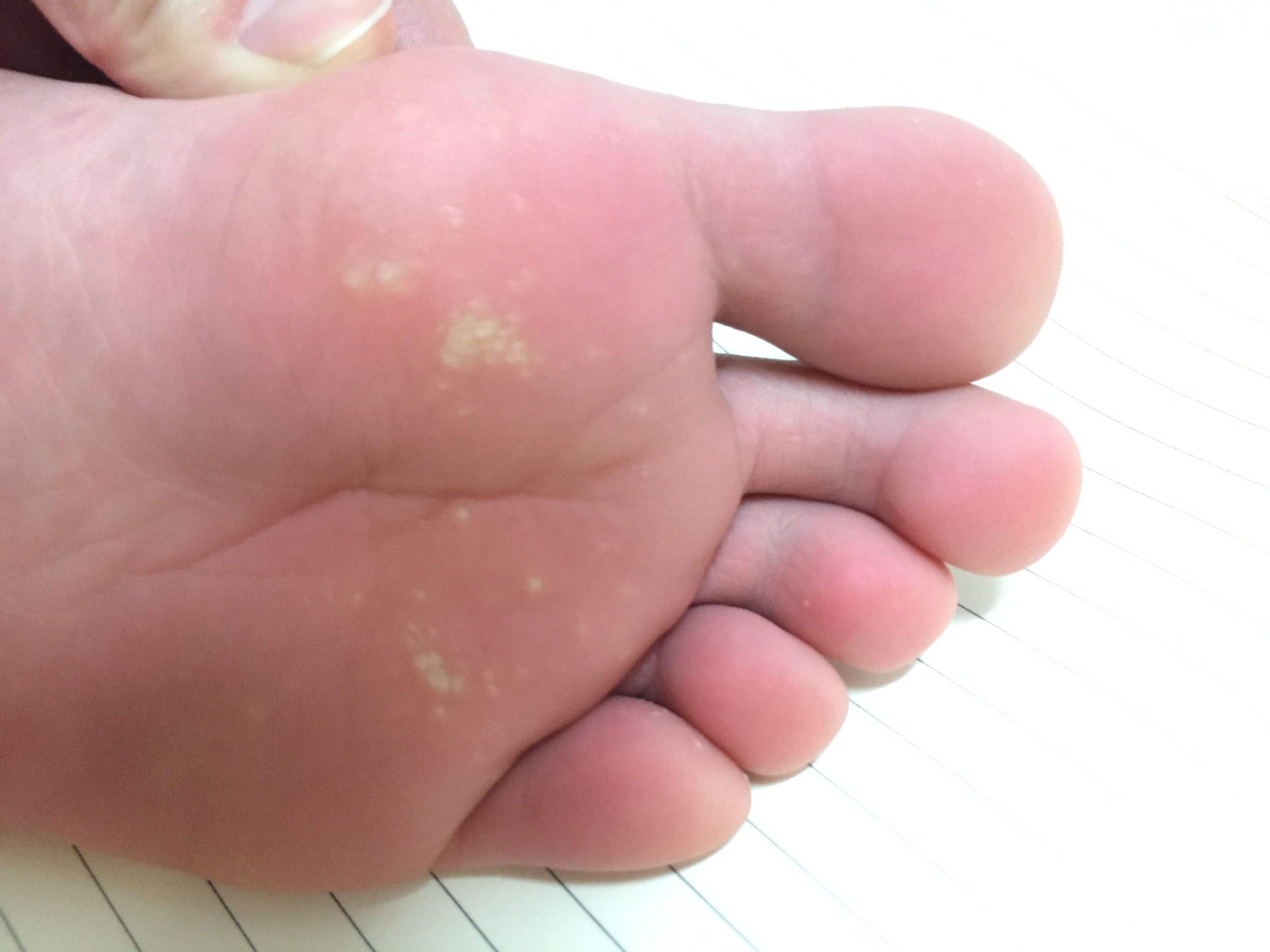 肝脏|脚部出现这3个异常，多半是肝脏问题找上你了，别不当回事儿