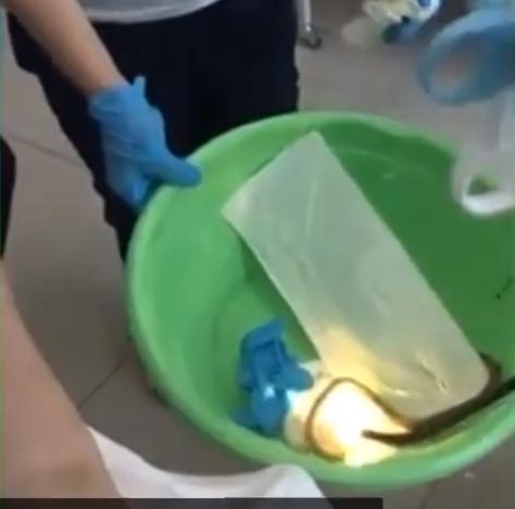 英国英鸟|1米长蛇趁俄女子睡觉钻舌入腹，医护惊恐将蛇取出，众人吓傻