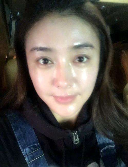 秦岚|秦岚素颜被“曝光”，整张脸居然都是疤？打了半个娱乐圈的脸