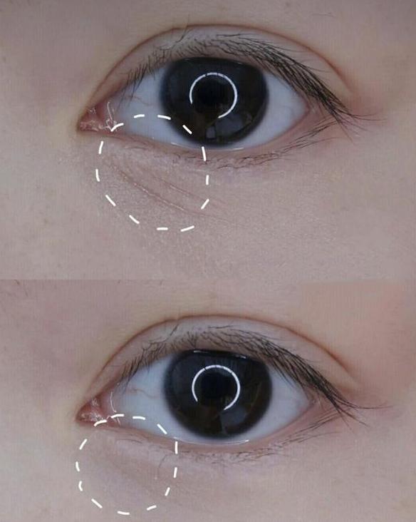 「眼霜」戚薇不小心晒出的“万能”眼霜，用后眼纹黑眼圈消失了，网友：平价兰蔻