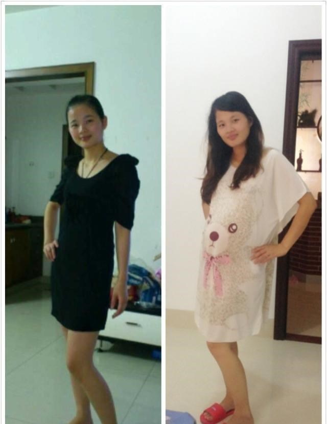 雌激素|女性是否生过孩子,过来人一看便知,3个部位的变化很明显