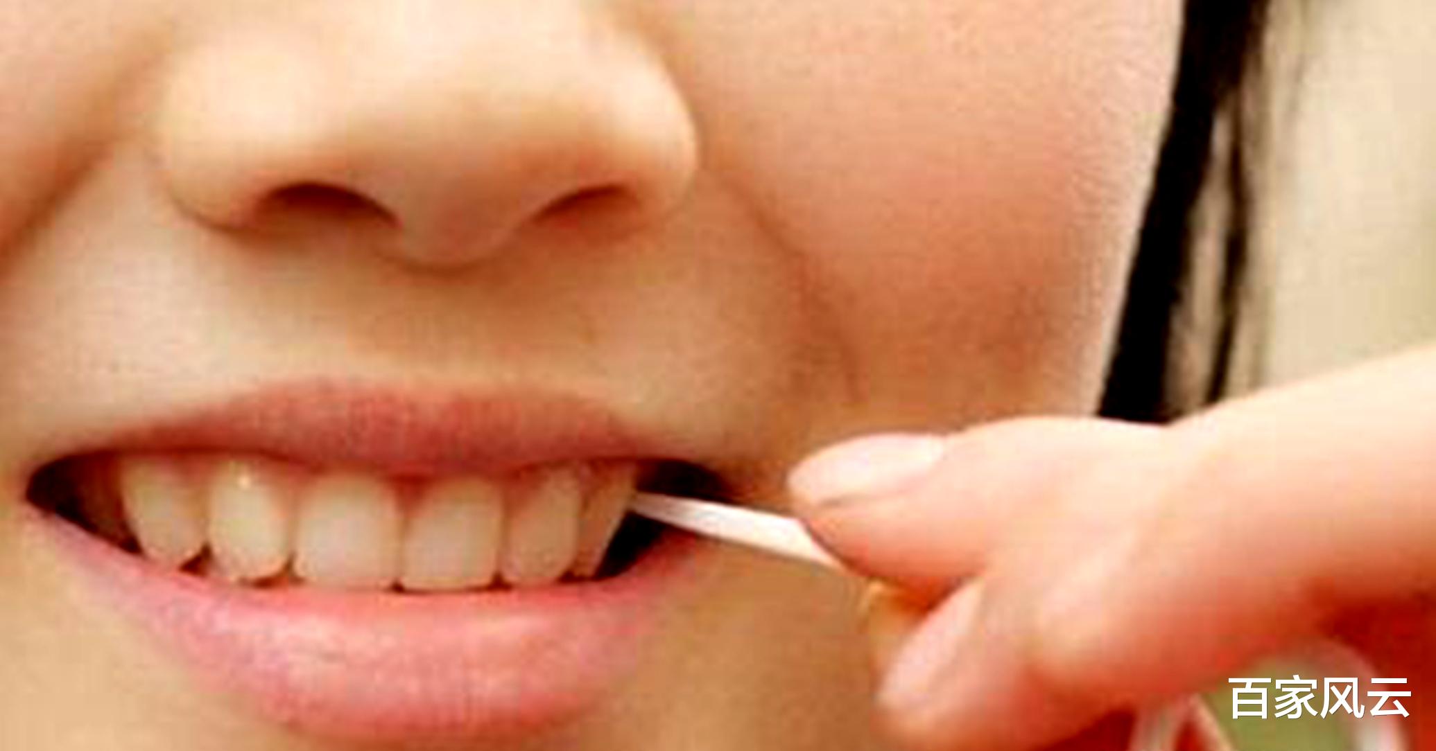 牙齿|牙缝掏出的“东西”，总是臭烘烘！学会简单一招，脏牙垢自己掉！
