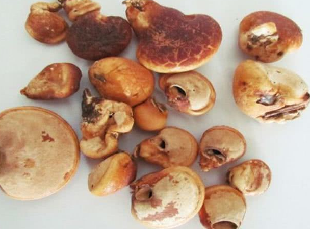 癌细胞：这4物是“天然抗癌物”，平时多吃，可能抑制“癌细胞”生长