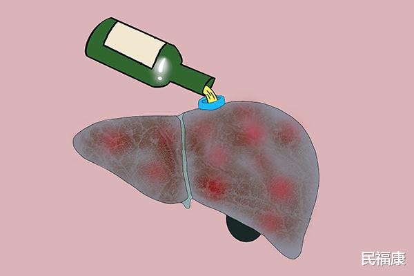 医生|适度饮酒对健康有益？医生坦言：3种癌症与酒精有关，需重视