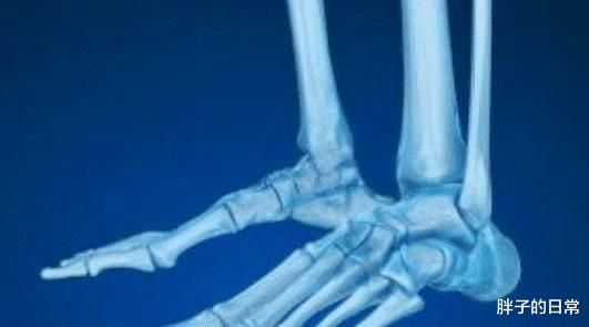 []人类全身骨头共206块，为什么中国人会少2块？听听专家们解释