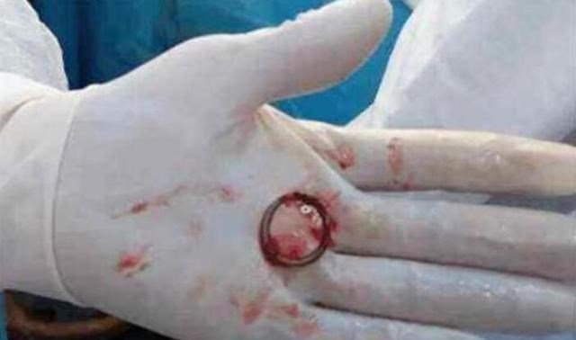 炒股的钱本金什么时候能取出|炒股的钱本金什么时候能取出