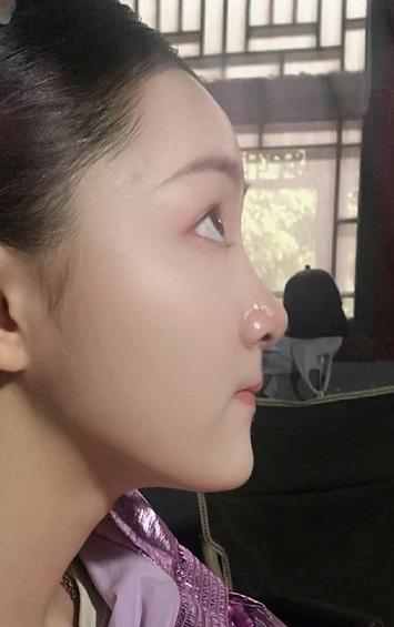 网红脸|14岁白娘子发育成“网红脸”？尖下巴，蛇精脸，网友：可惜了