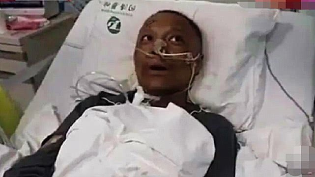 「李文亮」李文亮同事被感染,救回后身体产生这一变化,医院发文揭凶险时刻