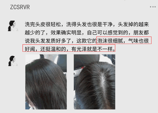 沙宣被洗发水界“阿玛尼”取代,头发出油扁塌全搞定,高露:我都用5年了