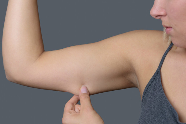 有氧运动|怎么正确减掉体内多余“赘肉”？记住3个误区，2个重点！