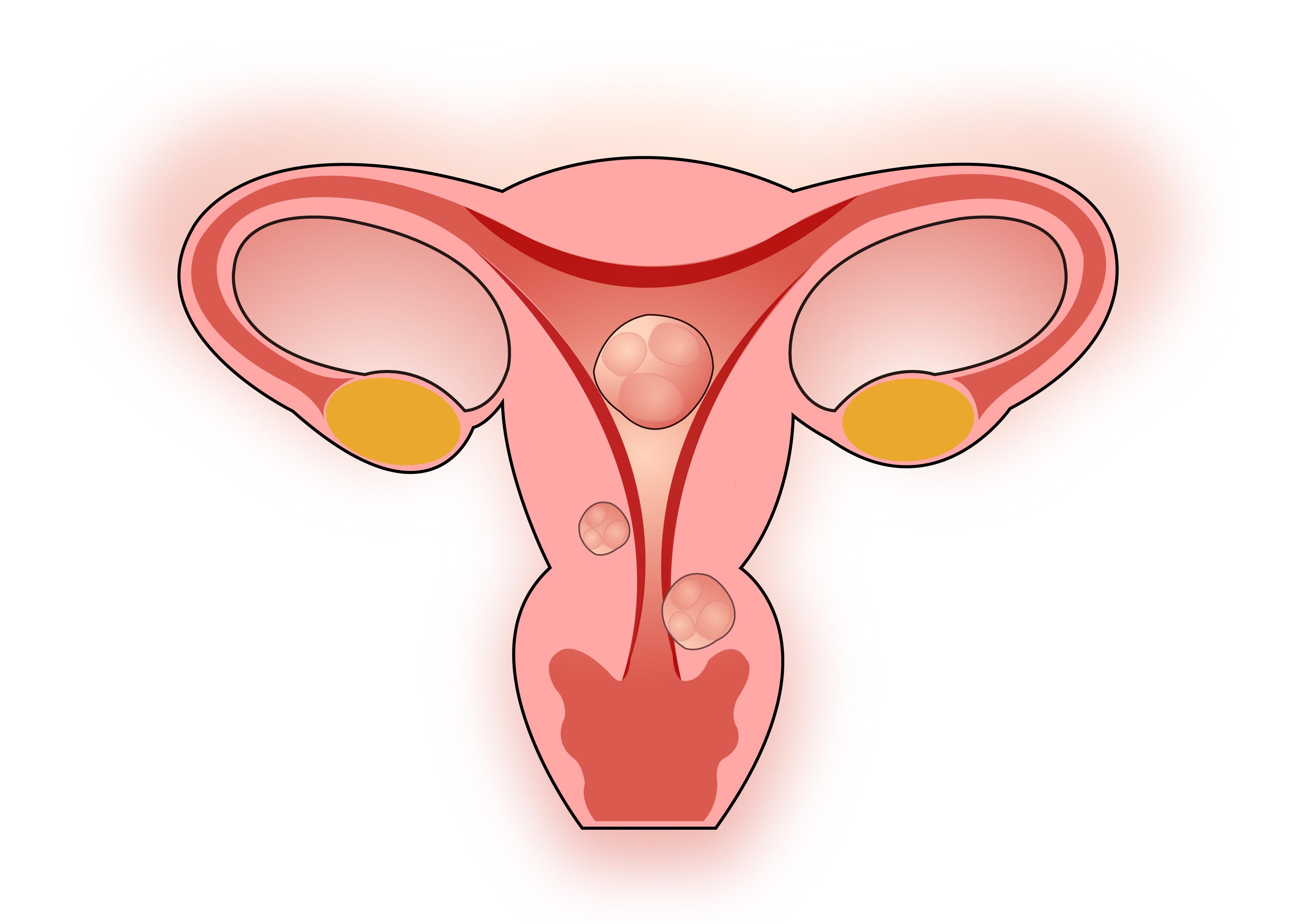 疾病|女人切了子宫,还能“行事”吗?了解3个常识,帮你消除认识误区