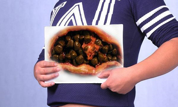 胆囊|切除胆囊，对身体会有什么坏处？医生说出3个后遗症，不得大意