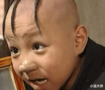 孟智超|他凭借“三毛”大火，因头皮受伤谢顶缝300针，今容貌大变无人识