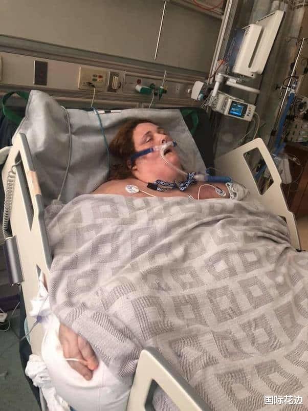|美国真人秀女星接受减肥手术离世，8名参加者都在节目播出后死亡