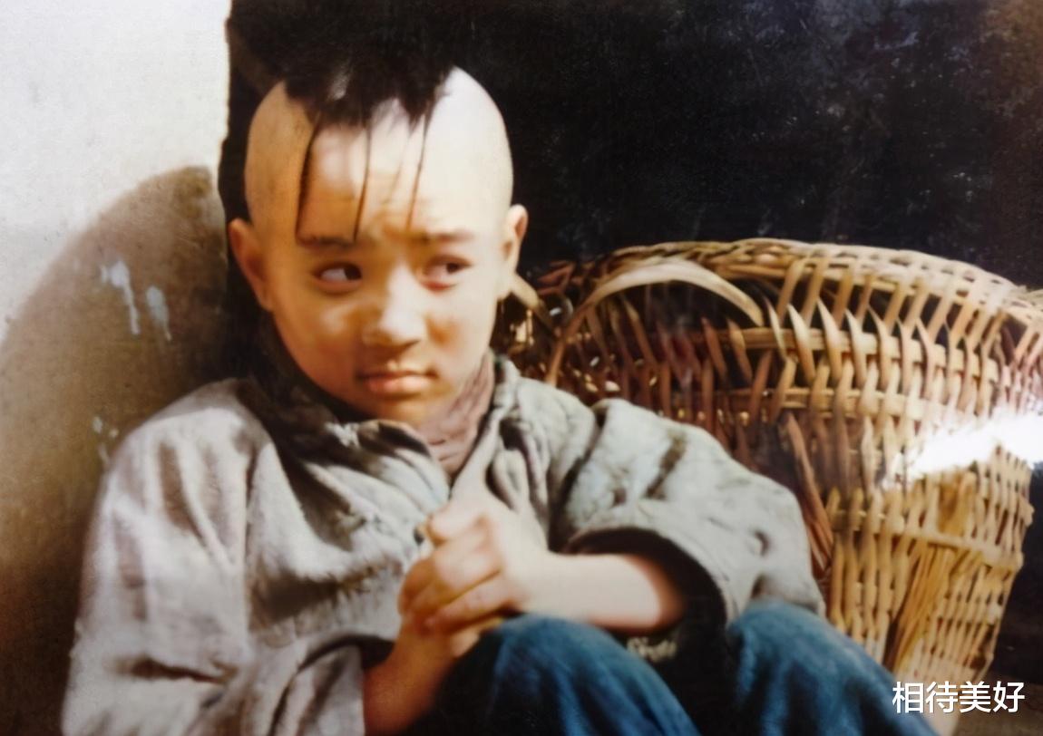 孟智超|为了演三毛，整天用胶水粘头发，年少秃顶为了植发忍痛扎400针