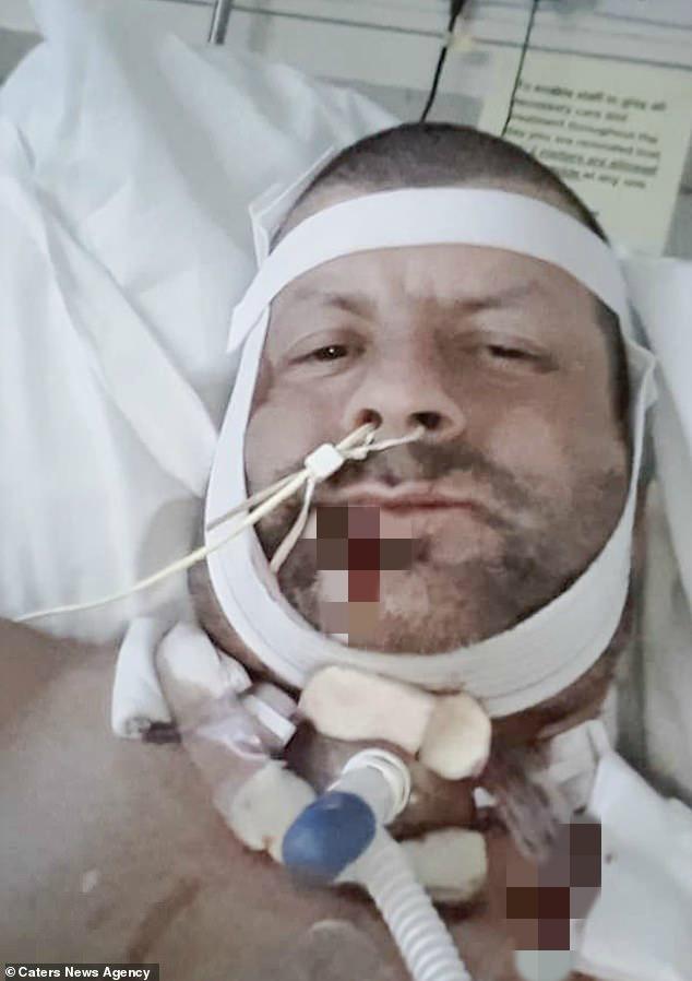 英国英鸟|英男子恐惧看牙医，27年后终做检查：下巴长拳头大肿瘤被迫摘除