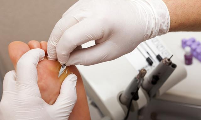 肝脏|脚上出现这三种信号，肝脏或许早已“烂如筛网”，请尽早检查