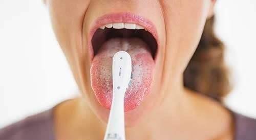 芒刺▲舌头下面的青筋为何会凸起？是身体出问题了？或是这两个问题作怪